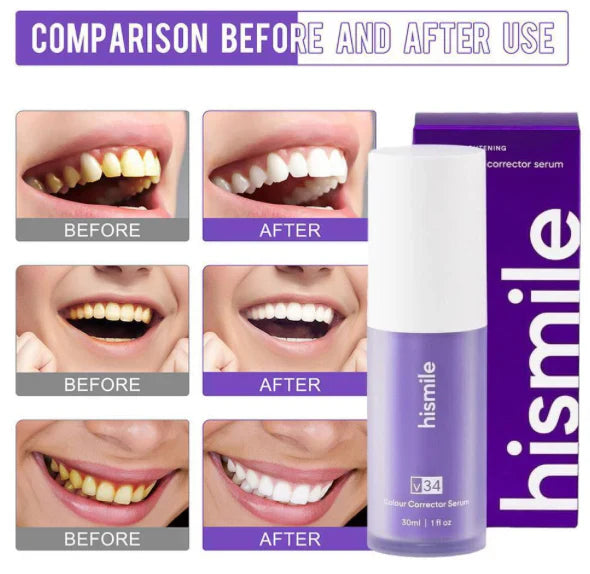 Hismile V34 Colour Corrector