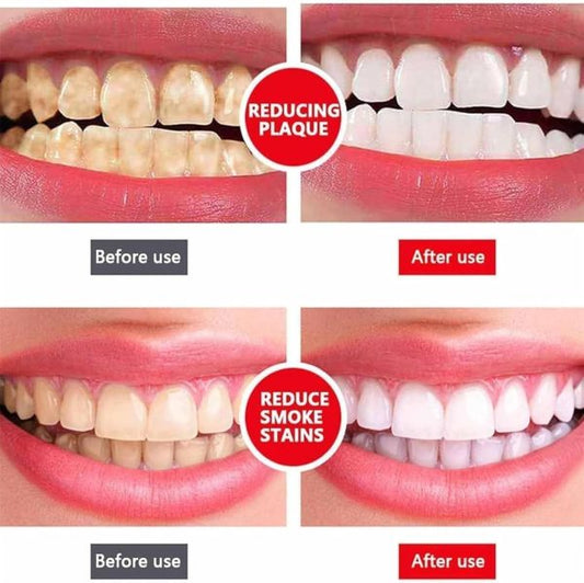 Yayashi Sp-4 Ultra Whitening Toothpaste | 120gm